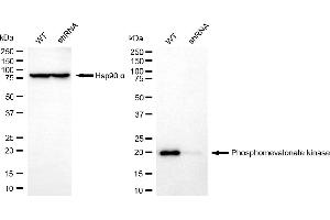 Western blotting analysis using phosphomevalonate kinase antibody (ABIN7799829).