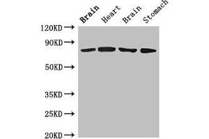 Western Blot Positive WB detected in: Rat brain tissue, Rat heart tissue, Mouse brain tissue, Mouse stomach tissue All lanes: SLCO1B1 antibody at 4 μg/mL Secondary Goat polyclonal to rabbit IgG at 1/50000 dilution Predicted band size: 77 kDa Observed band size: 77 kDa (SLCO1B1 antibody  (AA 426-537))