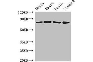 Western Blot Positive WB detected in: Rat brain tissue, Rat heart tissue, Mouse brain tissue, Mouse stomach tissue All lanes: SLCO1B1 antibody at 4 μg/mL Secondary Goat polyclonal to rabbit IgG at 1/50000 dilution Predicted band size: 77 kDa Observed band size: 77 kDa