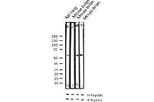 Western blot analysis of Phospho-Chk2 (Thr68) expression in various lysates
