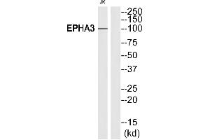 Western blot analysis of extracts from Jurkat cells, using EPHA3 (Ab-602)antibody. (EPH Receptor A3 antibody  (Internal Region))