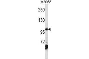 AP2B1 Antibody (Center) western blot analysis in A2058 cell line lysates (35µg/lane). (AP2B1 antibody  (Middle Region))