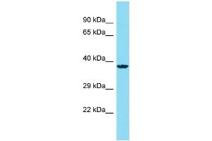 Host: Rabbit Target Name: C14orf79 Sample Type: HepG2 Whole Cell lysates Antibody Dilution: 1. (C14ORF79 antibody  (N-Term))