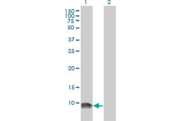 LSM6 anticorps  (AA 1-80)