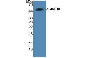 Detection of Recombinant LEP, Human using Polyclonal Antibody to Leptin (LEP) (Leptin antibody  (AA 22-167))