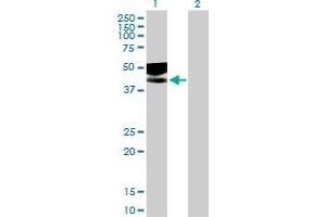 Western Blot analysis of IL1R2 expression in transfected 293T cell line by IL1R2 MaxPab polyclonal antibody. (IL1R2 antibody  (AA 1-398))