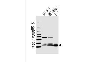 Western blot analysis of lysates from MCF-7, SK-BR-3, B-3 cell line (from left to right), using C13orf30 Antibody (C-term) (ABIN1944729 and ABIN2838567). (C13orf30 antibody  (C-Term))