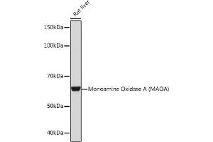 Western blot analysis of extracts of Rat liver, using Monoamine Oxidase A (MAOA) (MAOA) Rabbit mAb (ABIN1682632, ABIN3018542, ABIN3018543 and ABIN7101625) at 1:1000 dilution. (Monoamine Oxidase A antibody)