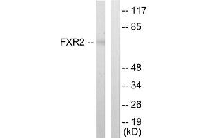 Western blot analysis of extracts from COLO205 cells, using FXR2 antibody. (FXR2 antibody  (C-Term))