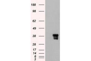 HEK293T cells were transfected with the pCMV6-ENTRY control (Left lane) or pCMV6-ENTRY DFFA (RC202879) (Right lane) cDNA for 48 hrs and lysed. (DFFA antibody  (AA 1-331))