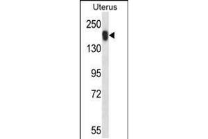 Western blot analysis in human normal Uterus tissue lysates (35ug/lane). (USP43 antibody  (C-Term))