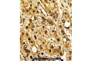 Immunohistochemistry (IHC) image for anti-Integrin, alpha X (Complement Component 3 Receptor 4 Subunit) (ITGAX) antibody (ABIN3002913) (CD11c antibody)