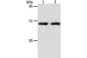 Western Blot analysis of Human liver cancer and fetal kidney tissue using ACOT11 Polyclonal Antibody at dilution of 1:650 (ACOT11 antibody)