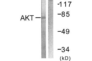 Immunohistochemistry analysis of paraffin-embedded human breast carcinoma tissue using Akt (Ab-326) antibody. (AKT1 antibody)