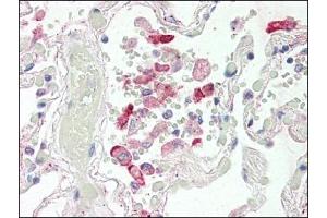 Image no. 1 for anti-Carboxylesterase 1 (CES1) (Internal Region) antibody (ABIN372769) (CES1 antibody  (Internal Region))