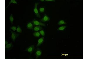 Immunofluorescence of monoclonal antibody to HNF4A on HeLa cell. (HNF4A antibody  (AA 324-423))