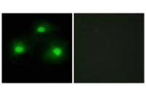 Immunofluorescence analysis of HeLa cells, using TPD52 antibody. (PKIA antibody)