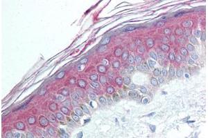 Human Skin (formalin-fixed, paraffin-embedded) stained with HDAC4 antibody ABIN292441 at 1:50 followed by biotinylated goat anti-rabbit IgG secondary antibody ABIN481713, alkaline phosphatase-streptavidin and chromogen. (HDAC4 antibody  (N-Term))