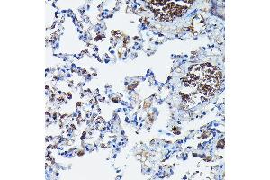Immunohistochemistry of paraffin-embedded rat lung using G Rabbit pAb (ABIN6129931, ABIN6137010, ABIN6137011 and ABIN6217659) at dilution of 1:100 (40x lens). (APOBEC3G antibody  (AA 60-330))