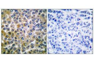 Immunohistochemistry (IHC) image for anti-SMAD, Mothers Against DPP Homolog 1 (SMAD1) (Ser465) antibody (ABIN1847896) (SMAD1 antibody  (Ser465))