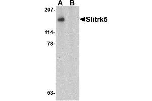 Western Blotting (WB) image for anti-SLIT and NTRK-Like Family, Member 5 (SLITRK5) (Middle Region 1) antibody (ABIN1031190) (SLITRK5 antibody  (Middle Region 1))