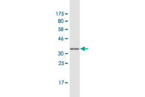 Western Blot detection against Immunogen (36. (RBP7 antibody  (AA 35-134))