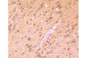 Paraformaldehyde-fixed, paraffin embedded mouse brain tissue, Antigen retrieval by boiling in sodium citrate buffer (pH6) for 15min, Block endogenous peroxidase by 3% hydrogen peroxide for 30 minutes, Blocking buffer (normal serum) at 37°C for 20min, Antibody incubation with PKC alpha(T638) (4B3) Monoclonal Antibody  at 1:50 overnight at 4°C, followed by a conjugated secondary and DAB staining. (PKC alpha antibody  (pThr638))