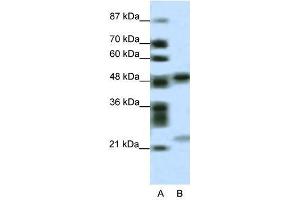 PHF11 antibody used at 0. (PHF11 antibody  (Middle Region))