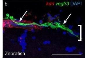Immunofluorescence (Paraffin-embedded Sections) (IF (p)) image for anti-Red Fluorescent Protein (RFP) antibody (ABIN964932)