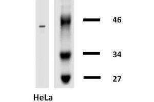 Western Blotting analysis of cytokeratin 18 in HeLa cells using anti-cytokeratin 18 biotin. (Cytokeratin 18 antibody  (Biotin))