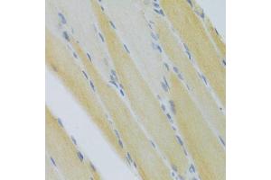 Immunohistochemistry of paraffin-embedded mouse skeletal muscle using CXCR3 Antibody (ABIN5971514) at dilution of 1/100 (40x lens). (CXCR3 antibody)