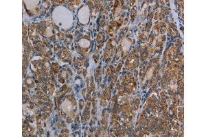 Immunohistochemistry of Human brain  using MYO7A Polyclonal Antibody at dilution of 1:30 (Myosin VIIA antibody)