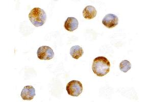 Immunohistochemistry (IHC) image for anti-Induced Myeloid Leukemia Cell Differentiation Protein Mcl-1 (MCL1) (N-Term) antibody (ABIN1031455)