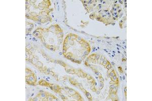 Immunohistochemistry of paraffin-embedded human kidney using ABCC1 Antibody (ABIN5971550) at dilution of 1/100 (40x lens). (ABCC1 antibody)