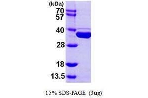 SDS-PAGE (SDS) image for Methyltransferase Like 1 (METTL1) (AA 1-276) protein (His tag) (ABIN667862)