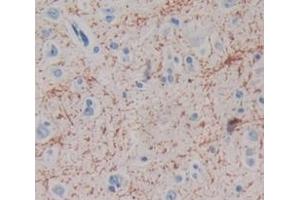 Used in DAB staining on fromalin fixed paraffin- embedded Kidney tissue (MAG antibody  (AA 328-514))
