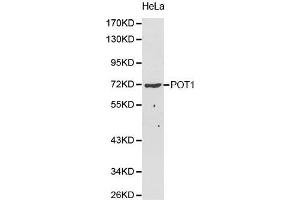 Western Blotting (WB) image for anti-Protection of Telomeres 1 (POT1) (AA 497-634) antibody (ABIN5663924) (POT1 antibody  (AA 497-634))