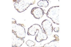 Immunohistochemistry of paraffin-embedded human placenta using FGFR2 antibody. (FGFR2 antibody  (AA 1-100))