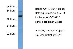 WB Suggested Anti-IQCB1  Antibody Titration: 0.