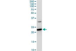 SEC22B monoclonal antibody (M03), clone 5A10. (SEC22B antibody  (AA 1-110))