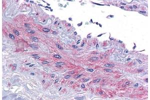 (ABIN571047) (3. (EIF5A antibody  (Internal Region))