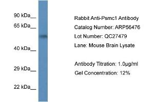 Western Blotting (WB) image for anti-Proteasome (Prosome, Macropain) 26S Subunit, ATPase, 1 (PSMC1) (C-Term) antibody (ABIN2774148) (PSMC1 antibody  (C-Term))