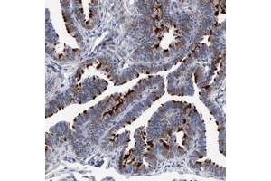 Immunohistochemical staining of human fallopian tube with C7orf57 polyclonal antibody  shows strong positivity in ciliated cells at 1:20-1:50 dilution. (C7ORF57 antibody)