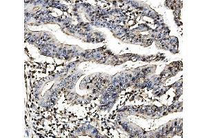 IHC analysis of MORC3 using anti-MORC3 antibody (ABIN7602764).