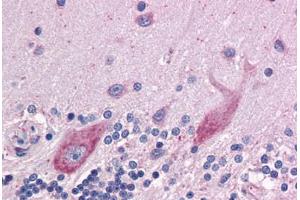 Human Brain, cerebellum: Formalin-Fixed, Paraffin-Embedded (FFPE) (DPF2 antibody  (AA 56-155))