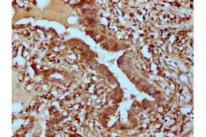 IHC image of ABIN7163100 diluted at 1:400 and staining in paraffin-embedded human lung tissue performed on a Leica BondTM system. (PHACTR1 antibody  (AA 263-387))