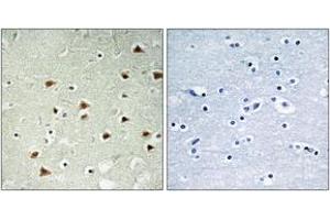 Immunohistochemistry analysis of paraffin-embedded human brain tissue, using ABHD14B Antibody. (ABHD14B antibody  (AA 161-210))
