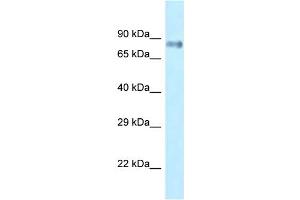 WB Suggested Anti-Lrrfip1 Antibody Titration: 1. (LRRFIP1 antibody  (C-Term))