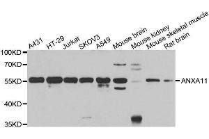 Western blot analysis of extracts of various cell lines, using ANXA11 antibody. (Annexin A11 antibody  (AA 276-505))
