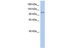 Image no. 1 for anti-Zinc Finger Protein 217 (ZNF217) (AA 71-120) antibody (ABIN6742391) (ZNF217 antibody  (AA 71-120))